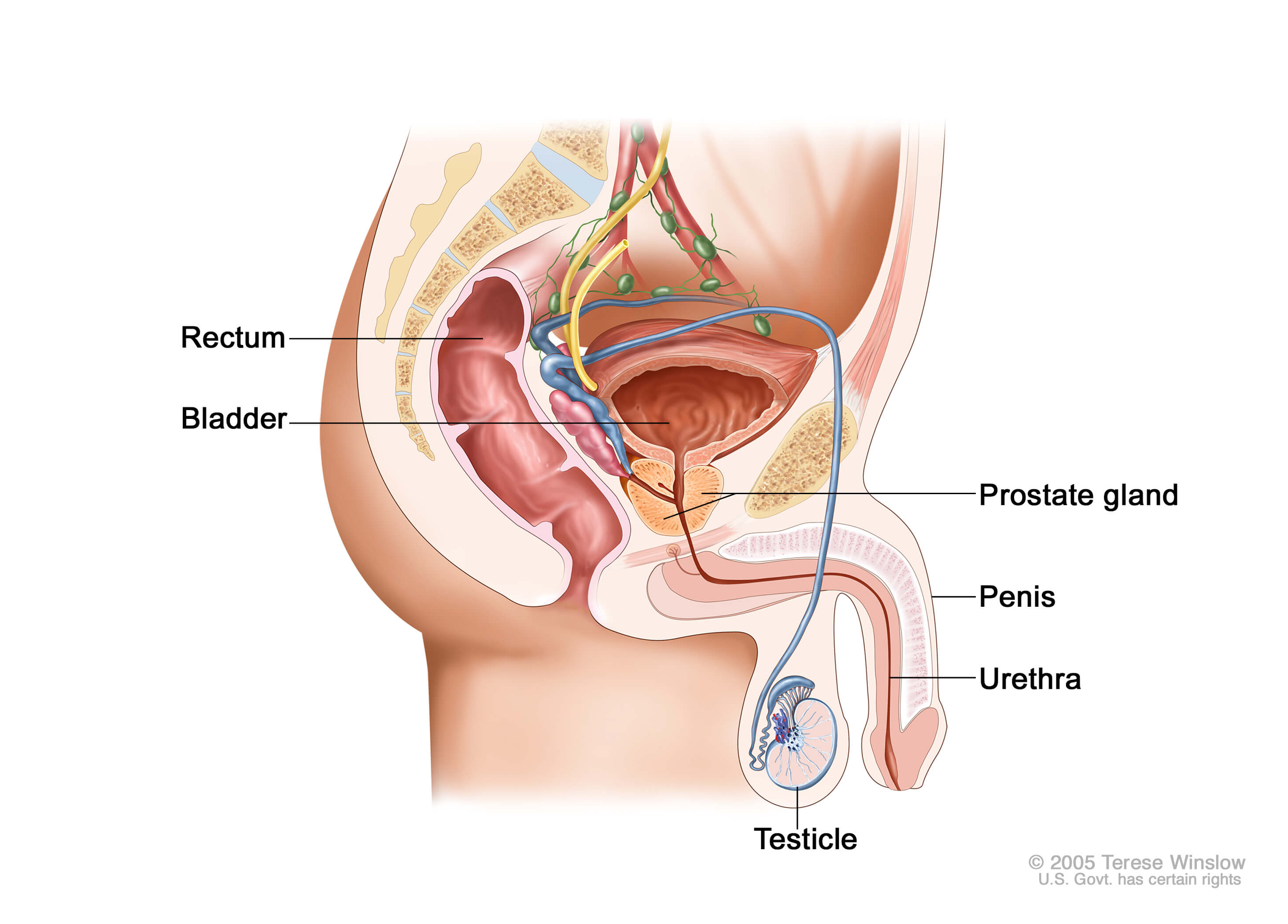 prostate cancer pain in groin