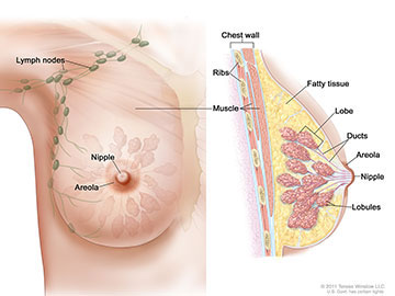 Drawing of female breast anatomy showing the lymph nodes, nipple, areola, chest wall, ribs, muscle, fatty tissue, lobe, and ducts.