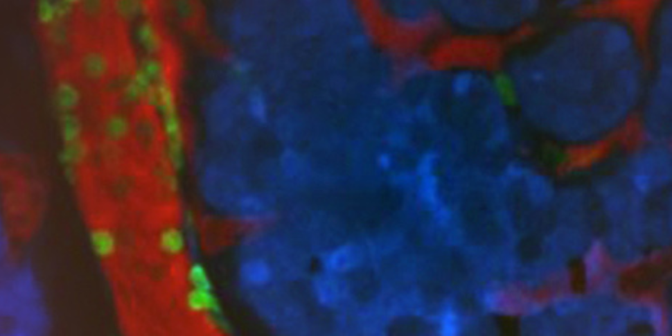 Immunofluorescent image of a tumor microenvironment