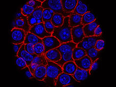 Pancreatic cancer cells growing in a sphere-shaped cluster.