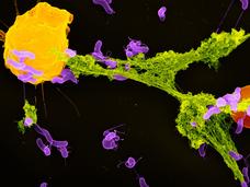 An electron microscope image of a neutrophil ejecting a NET that has captured bacteria