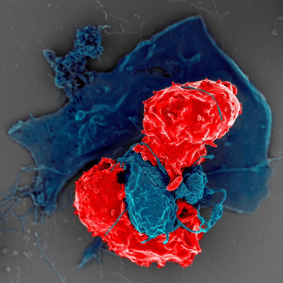 Imagen de la interacción entre los linfocitos T reguladores y las células presentadoras de antígeno,  generada con microscopio electrónico de barrido.