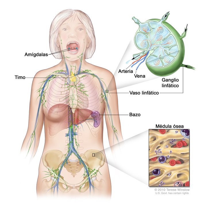 Resultado de imagen para Un cÃ¡ncer en el sistema linfÃ¡tico