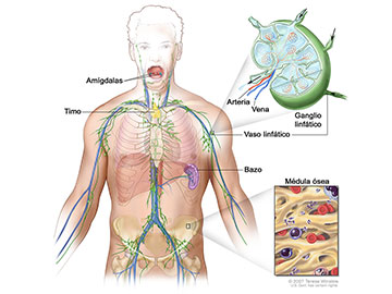 Anatomía del sistema linfático; se muestran los vasos linfáticos y los órganos linfáticos, incluidos los ganglios linfáticos, las amígdalas, el timo, el bazo y la médula ósea. La linfa (un líquido claro) y los linfocitos se desplazan a través de los vasos linfáticos hasta los ganglios linfáticos, donde los linfocitos destruyen las sustancias que son dañinas. La linfa entra en la sangre a través de una vena grande cerca del corazón.