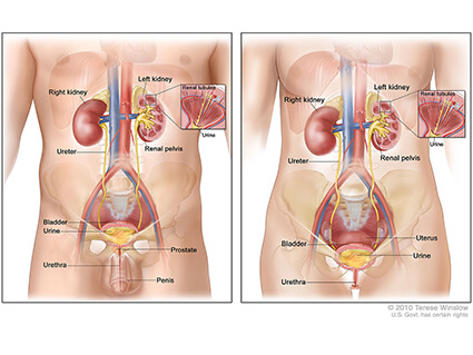 Anatomy of the male urinary system (left panel) and female urinary system (right panel) showing the kidneys, ureters, bladder, and urethra. Urine is made in the renal tubules and collects in the renal pelvis of each kidney. The urine flows from the kidneys through the ureters to the bladder. The urine is stored in the bladder until it leaves the body through the urethra.