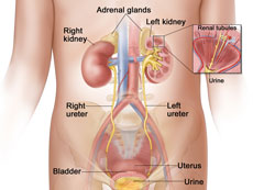 Wilms tumor is the most common type of kidney cancer in children