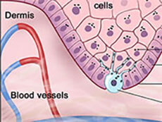 Illustration of the epidermis.