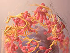 Diagram of a three-dimensional structure of a melanoma cell