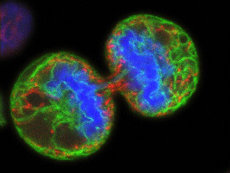 Melanoma cells dividing
