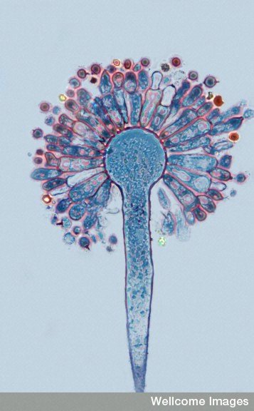 MicrografÃ­a, teÃ±ida de azul, de la esporulaciÃ³n de un hongo llamado Aspergillus.