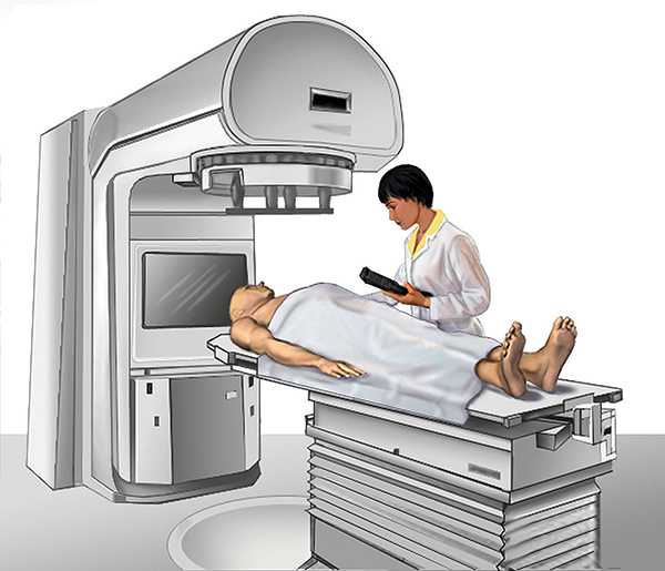 Linear Accelerator Used for External-beam Radiation Therapy