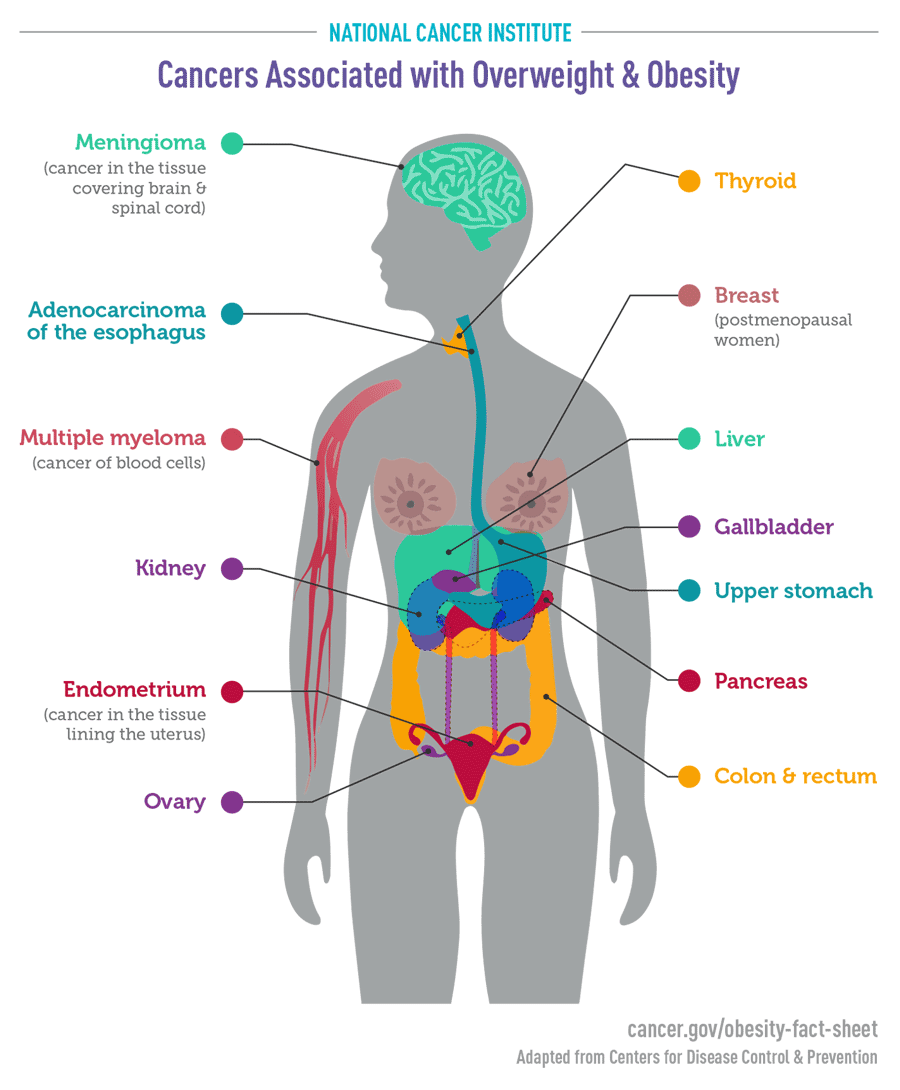 Cancers Associated With Overweight And Obesity