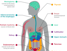 Infographic of Cancers Associated with Overweight and Obesity