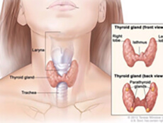 Anatomy of the thyroid and parathyroid glands; illustration shows the thyroid gland at the base of the throat near the trachea. An inset shows the front and back views. The front view shows that the thyroid is shaped like a butterfly, with the right lobe and left lobe connected by a thin piece of tissue called the isthmus. The back view shows the four pea-sized parathyroid glands. The larynx is also shown.