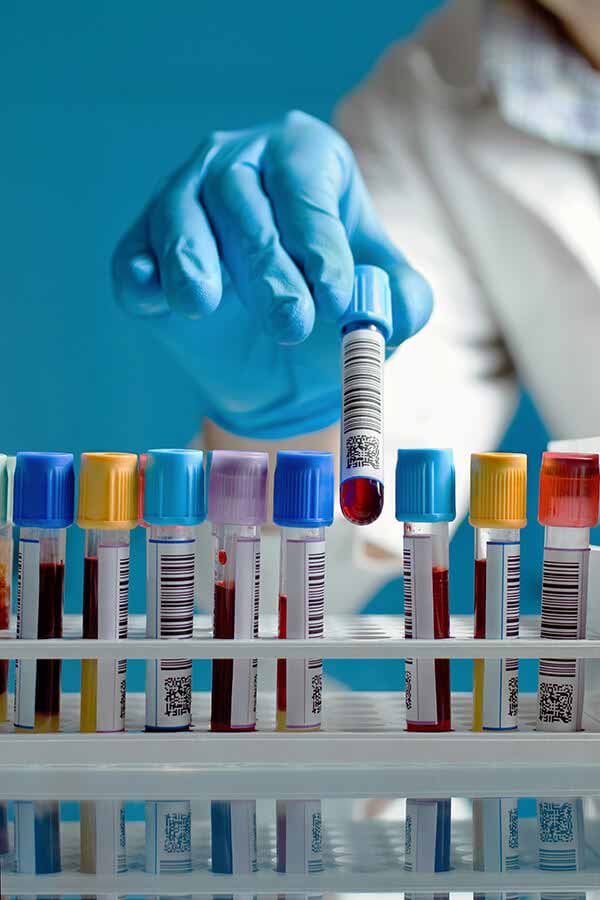 Hand picking up a vial of blood from a tray