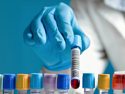 Hand picking up a vial of blood from a tray