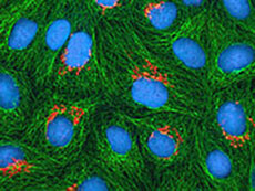 A fluorescence image of cultured HeLa cells