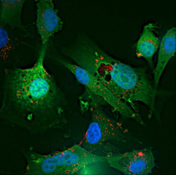 Glioblastoma cells