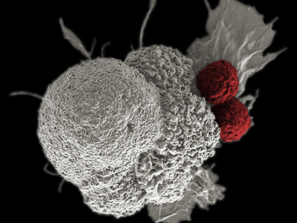 Papel del NCI en la investigación de inmunoterapia