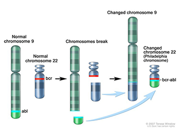 Illustration of translocation, which is when pieces from two different chromosomes trade places and create changed chromosomes. For CML, part of chromosome 9 replaces part of chromosome 22 and creates the Philadelphia chromosome