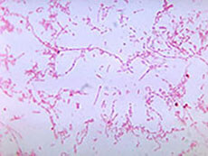 An image of the bacteria Fusobacterium necrophorum