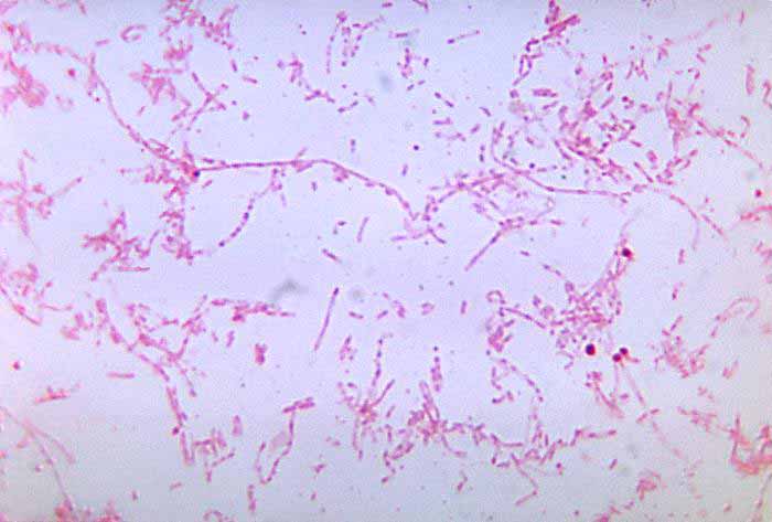 An image of the bacteria Fusobacterium necrophorum