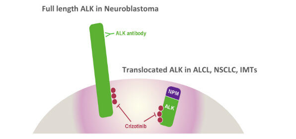 The gene EML4 is a common fusion partner in cancers with ALK gene alterations known as translocations.