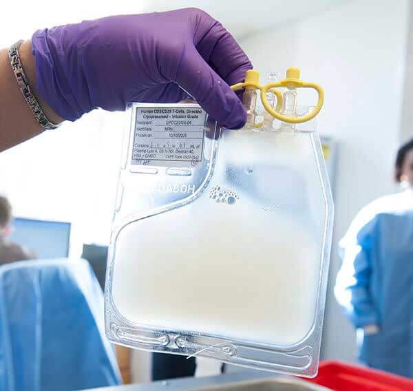 Manufactured CAR T cells ready for infusion into a patient