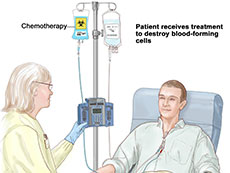 patient receiving chemotherapy