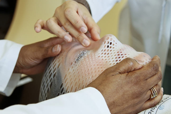 The hands of two radiation therapists are shown fitting a short face mask to a patient model to steady the head during radiation therapy.