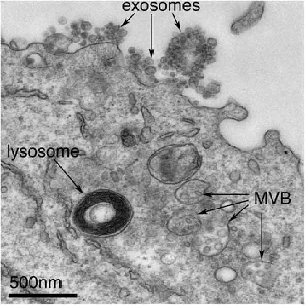 A transmission electron micrograph of a cancerous B cell that has secreted exosomes.