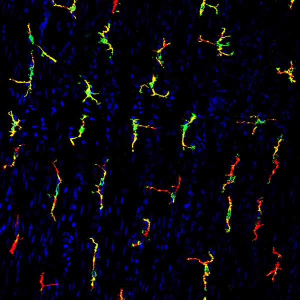 receptor on immune cells called macrophages 