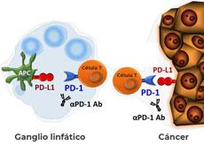 Los anticuerpos monoclonales (Ab) del inhibidor de punto de control inmunitario que bloquean proteínas PD-1 actúan sobre las células inmunitarias de los ganglios linfáticos y las células inmunitarias y cancerosas de los tumores.