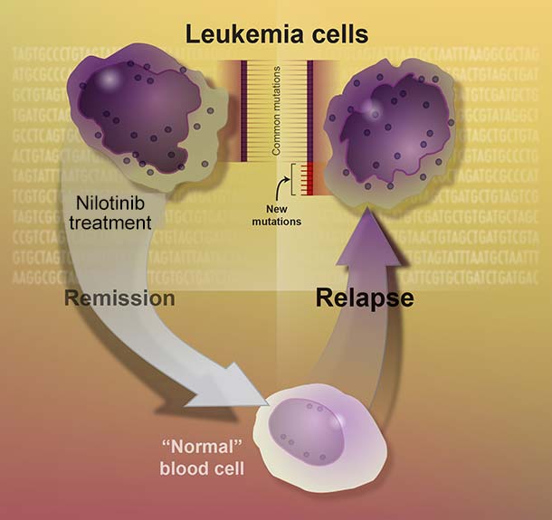 Leukemia cells undergoing remission and relapse