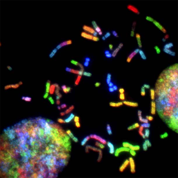 Chromosomes from a malignant glioblastoma visualized by spectral karyotyping.