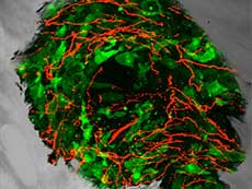 Fibras nerviosas sensoriales (en rojo) creciendo dentro de las células de un tumor de próstata (en verde) que ha formado metástasis en el hueso.