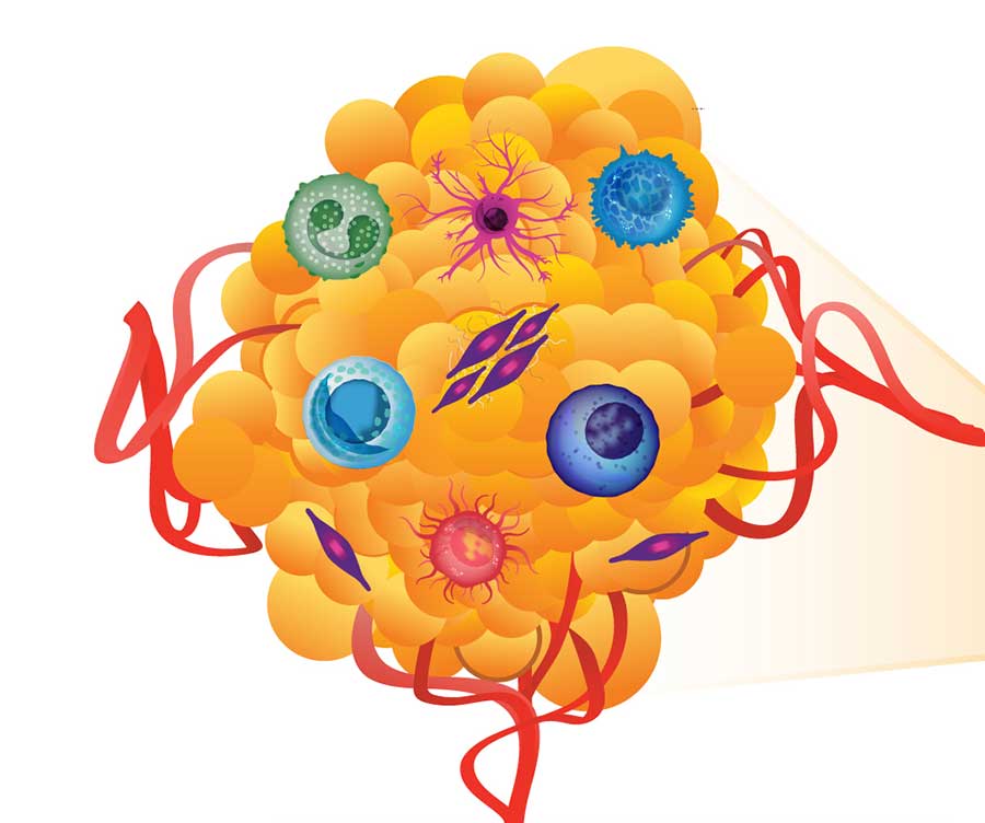 An illustration of a tumor and its microenvironment.