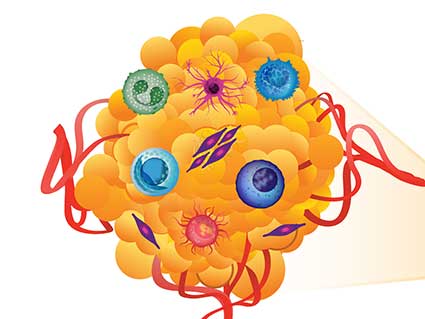 An illustration of a tumor and its microenvironment.