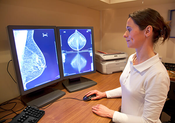 Technician looking at mammogram x-rays