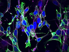 Mouse embryonic fibroblasts that were quiescent owing to deletion of all RAS genes were rescued with GFP-HRAS, and subsequently stained for nuclei (DAPI, blue) and actin (antibody, magenta).
