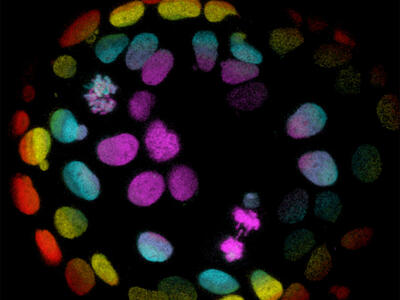 Microscopic image of colorectal cells grown into organoids