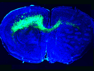 Image of the infiltration of malignant glioma cells (green) throughout a mouse brain (blue) alters brain circuits towards hyperexcitability and sets a stage favorable for glioma growth.