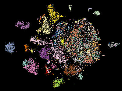 A tumor microenvironment map
