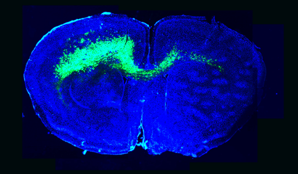 Image of the infiltration of malignant glioma cells (green) throughout a mouse brain (blue) alters brain circuits towards hyperexcitability and sets a stage favorable for glioma growth.
