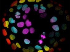 Microscopic image of colorectal cells grown into organoids