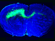 Image of the infiltration of malignant glioma cells (green) throughout a mouse brain (blue) alters brain circuits towards hyperexcitability and sets a stage favorable for glioma growth.