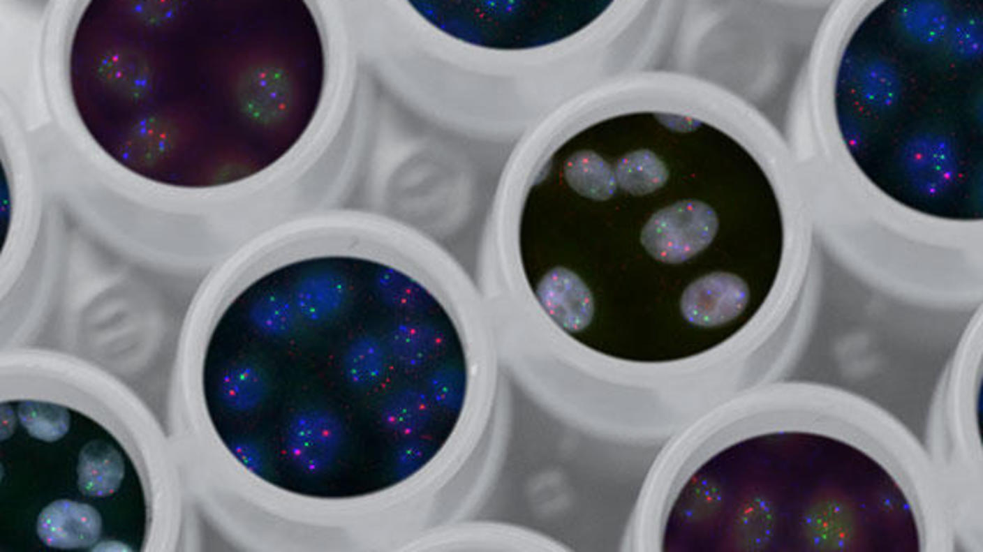 Florescent dyes highlight genes of cells growing in multi-well plates.