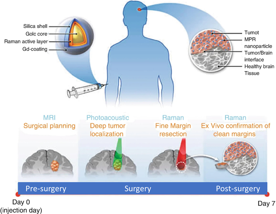 Nanotechnology and Early Cancer Detection and Diagnosis - NCI