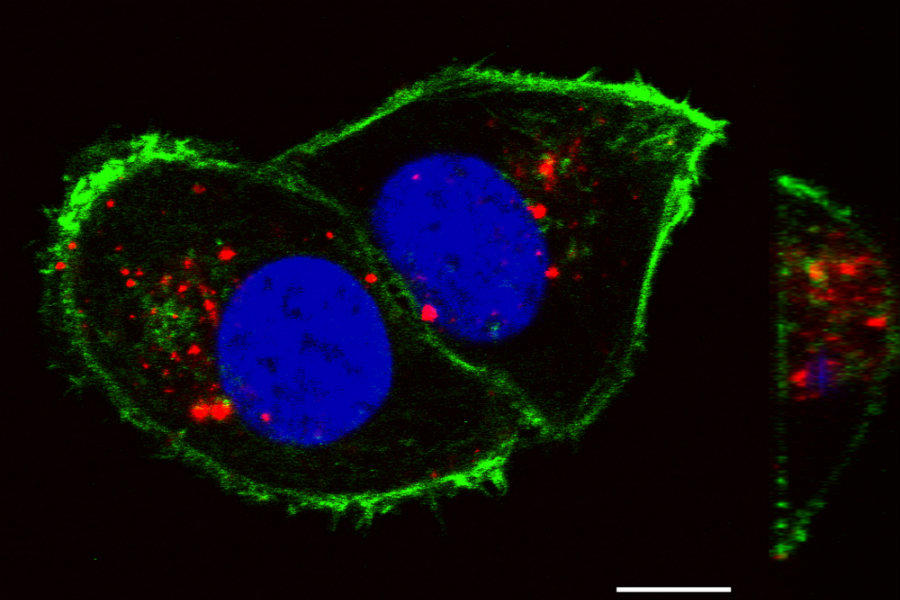 Confocal laser scanning microscopy image showing kidney cancer cells labeled by phosphorylcholine-coated semiconducting polymer nanoparticles.