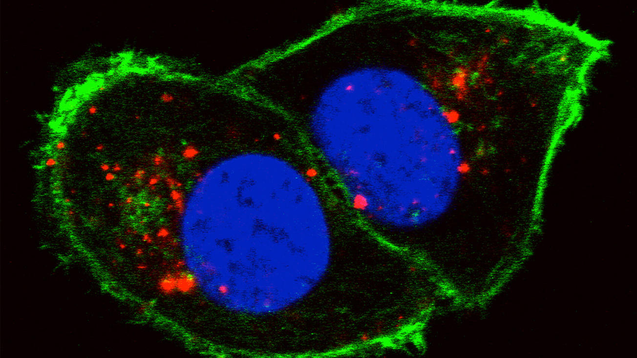 Confocal laser scanning microscopy image showing kidney cancer cells labeled by phosphorylcholine-coated semiconducting polymer nanoparticles.